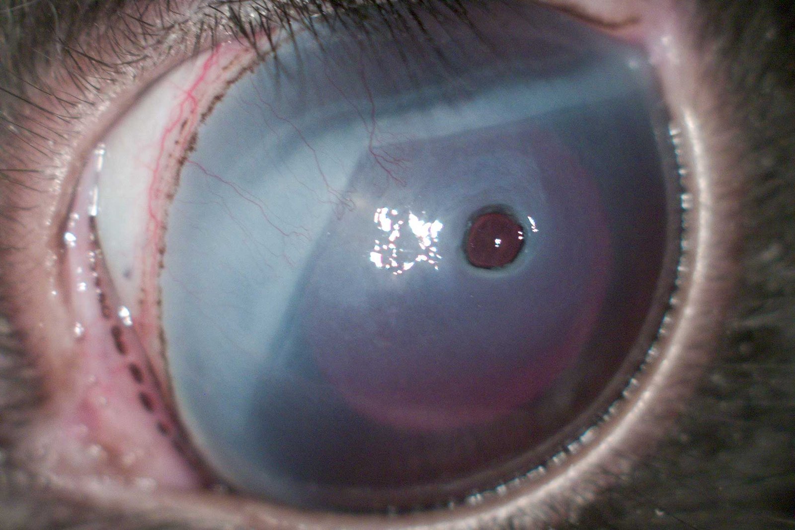 Corneal ulcer